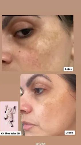 Kit timewise 3D da Mary Kay