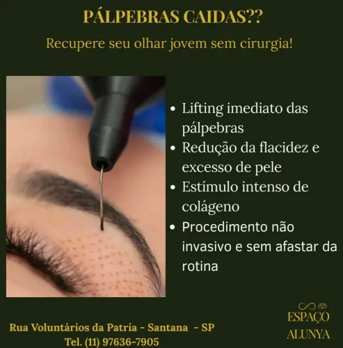 Blefaroplastia sem cortes