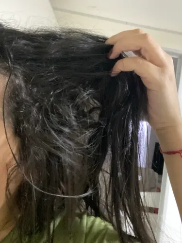 Você sofre com queda de cabelo?