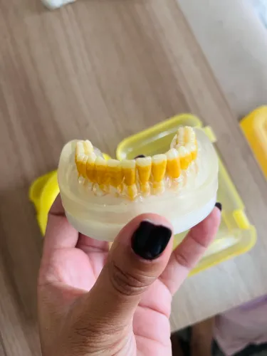 Refil de Periodontia Pronew