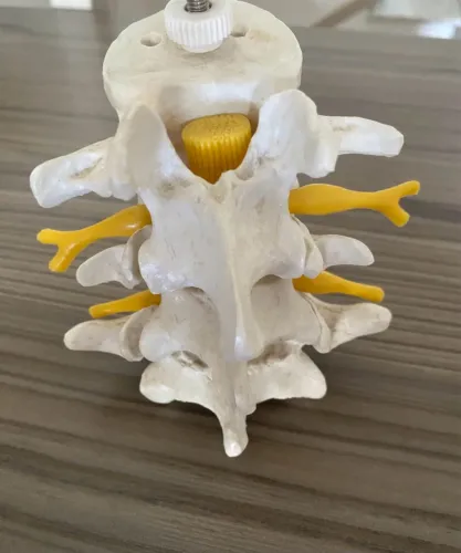 Modelo Anatômico de Vértebras Lombares