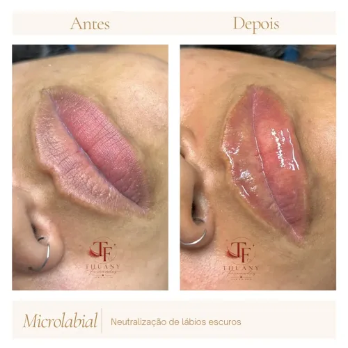 Micropigmentação labial 