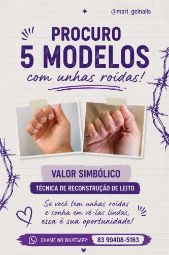 Unha em Gel | Reconstrução de Leito Roído | Valor Simbólico