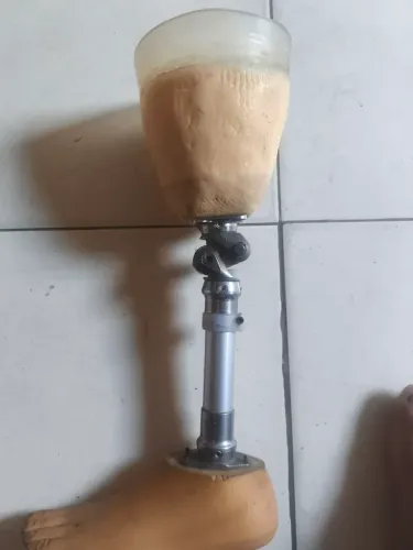 perna mecânica