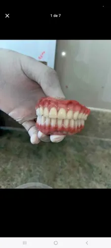 Trabalho Com Prótese Dentaria A Domicílio 