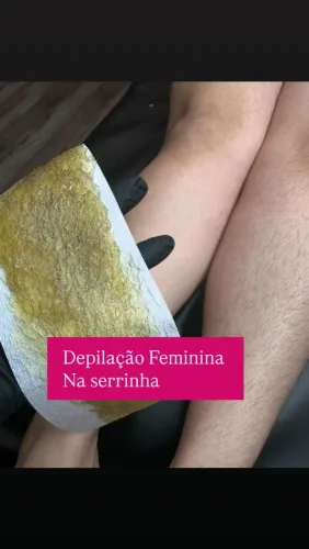 Depilação feminina