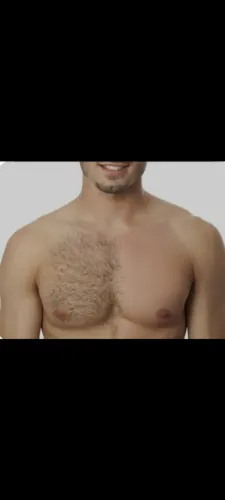 Depilação com cera quente 