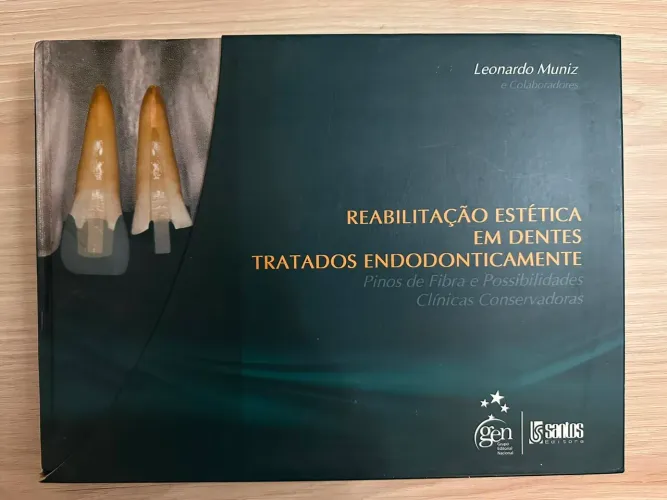 Reabilitação Estética em Dentes Tratados Endodonticamente
