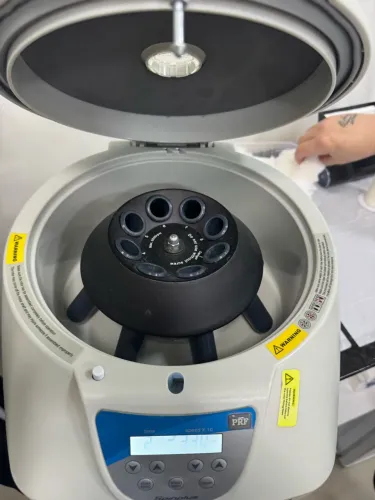 Centrifuga de prf/ prt