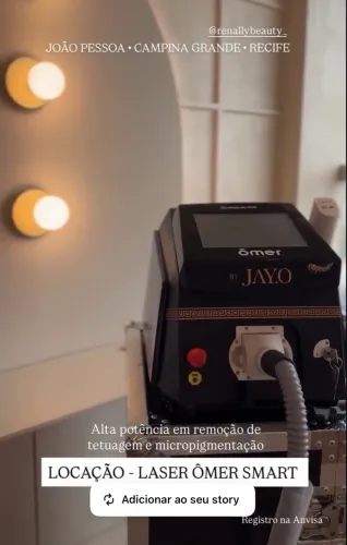 Locação - Laser Remoção de Tatuagem e Micro