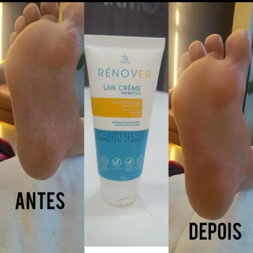 Creme para pés RENOOVER Lan Crème Prebiótico - 90g