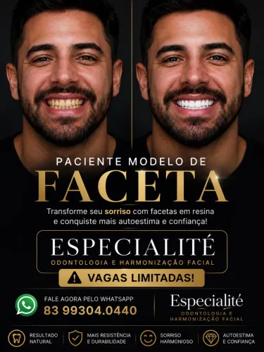 PACIENTE MODELO PARA FACETAS EM RESINA EM JOÃO PESSOA