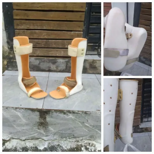 Botas ortopédicas para recuperação de fratura