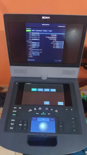 Ultrassom Portátil Edam