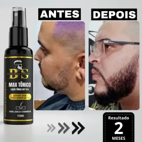 Promoção Shopee! Tônico Capilar Max - Ideal para Cabelo, Barba e Sobrancelhas