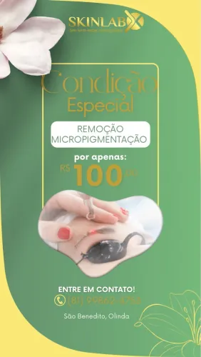 Remoção de Micropigmentação por R$100,00!