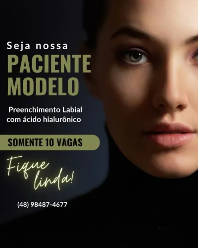 Preenchimento labial - paciente modelo