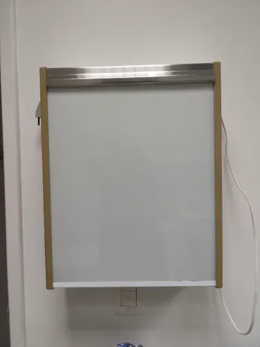 Negatoscópio