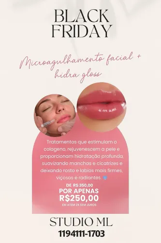Microagulhamento facial e hidra glos