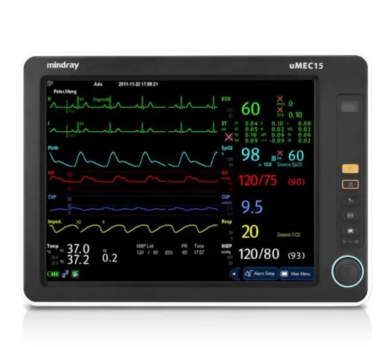 Monitor Multiparamétrico Mindray uMEC15 - 15? - EtCO? + 2 PI - Comprado Novo há 1 Ano