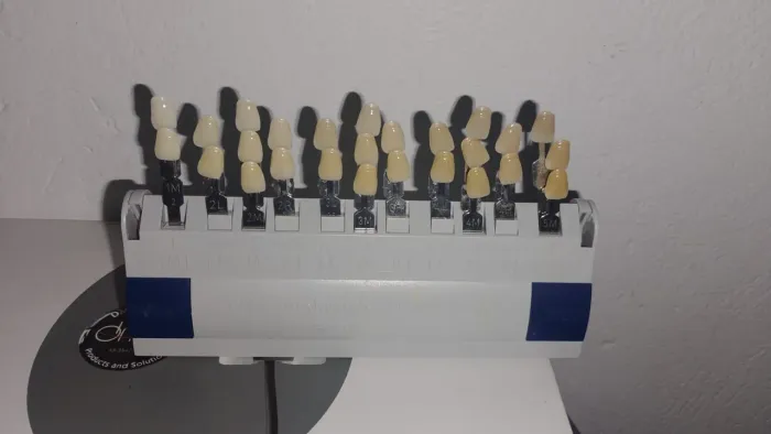 Vendo Escala Vitta