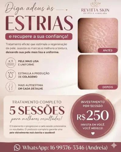 Tratamento de estrias 