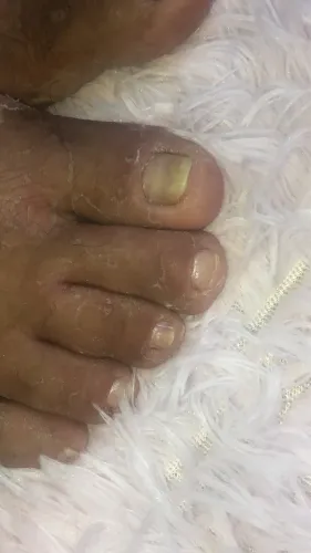 ESMALTAÇAO EM GEL DECORADA