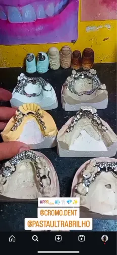 Prótese dentária
