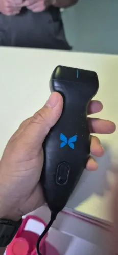 Butterfly iQ+ + licença do app vitalícia (menos de um ano de uso)