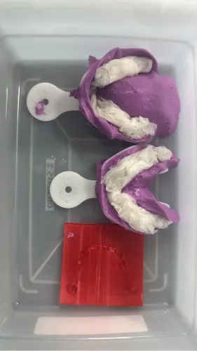 Facetas de resina. Próteses dentárias limpeza protocolos. Servicos. odontológicos