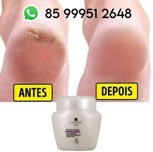 Corps Lignea Hydra Power - Tratamento para os pés