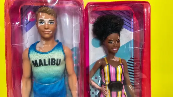 Kit Barbie e Ken Fashionistas Mattel Vitiligo