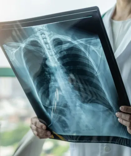 Reciclagem Chapas raio X R$10,00