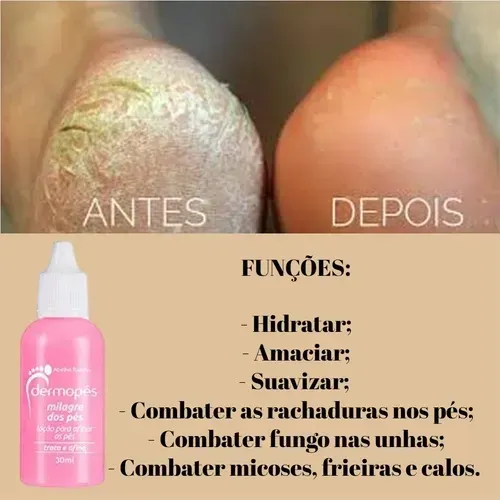 Dermopés milagre dos pés