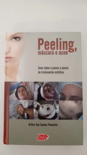 Peeling, máscara e acne - Arthur dos Santos Pimentel
