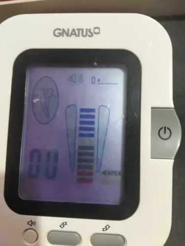 Localizador Apical Gnatus Endus Seminovo - Completo Na Caixa E Funcionando