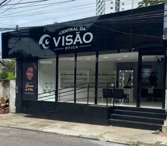 Repasse ótica casa amarela