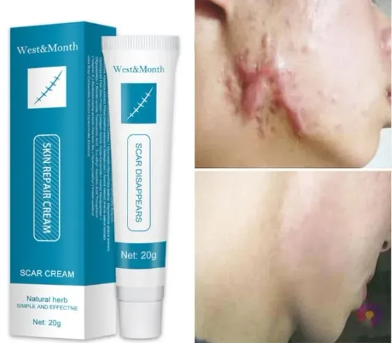 2Un. West&month Creme De Reparo Para Remoção De Cicatrizes 20g
