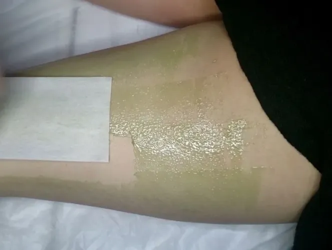 Depilação face e corpo 