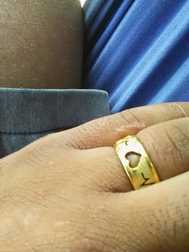 (VENDO) ANÉIS, ALIANÇAS 316L DE COR DOURADO O MESMO DE INSTRUMENTOS CIRÚRGICOS?