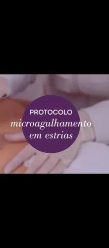 Estrias