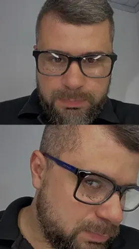 Óculos para GRAU MASCULINOS 
