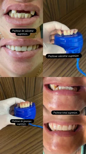 Laboratório de prótese dentária .