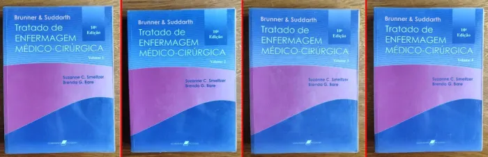 Livro - Tratado De Enfermagem Médico-cirúrgica - 10ª Edição - Muito Conservado