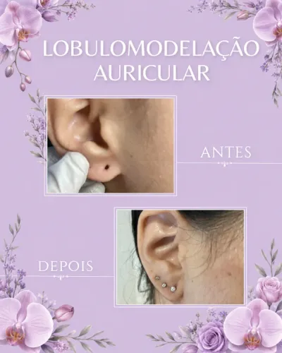 Body piercing 