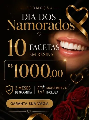 Facetas em resina