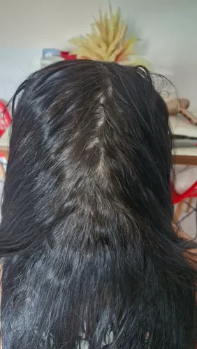 Selagem á domicílio