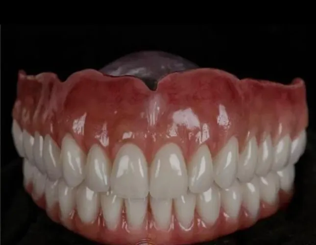 Prótese Dentária 