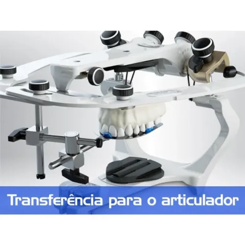 Vendo articulador Asa com arco e kit de curetas quinelato