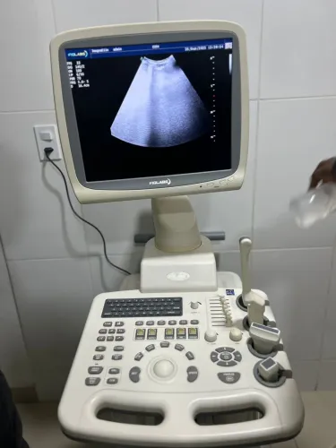 Aparelho de ultrassom figlabs